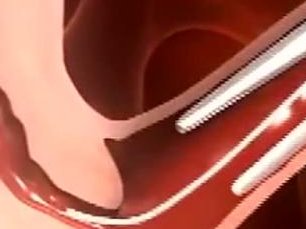 孕26周宫缩莫慌张，做好这些措施保胎成功率也不低