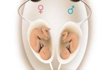 女性有染色体罗氏易位在孝义市做试管养囊成功率高吗？试管移植后需要保胎吗！